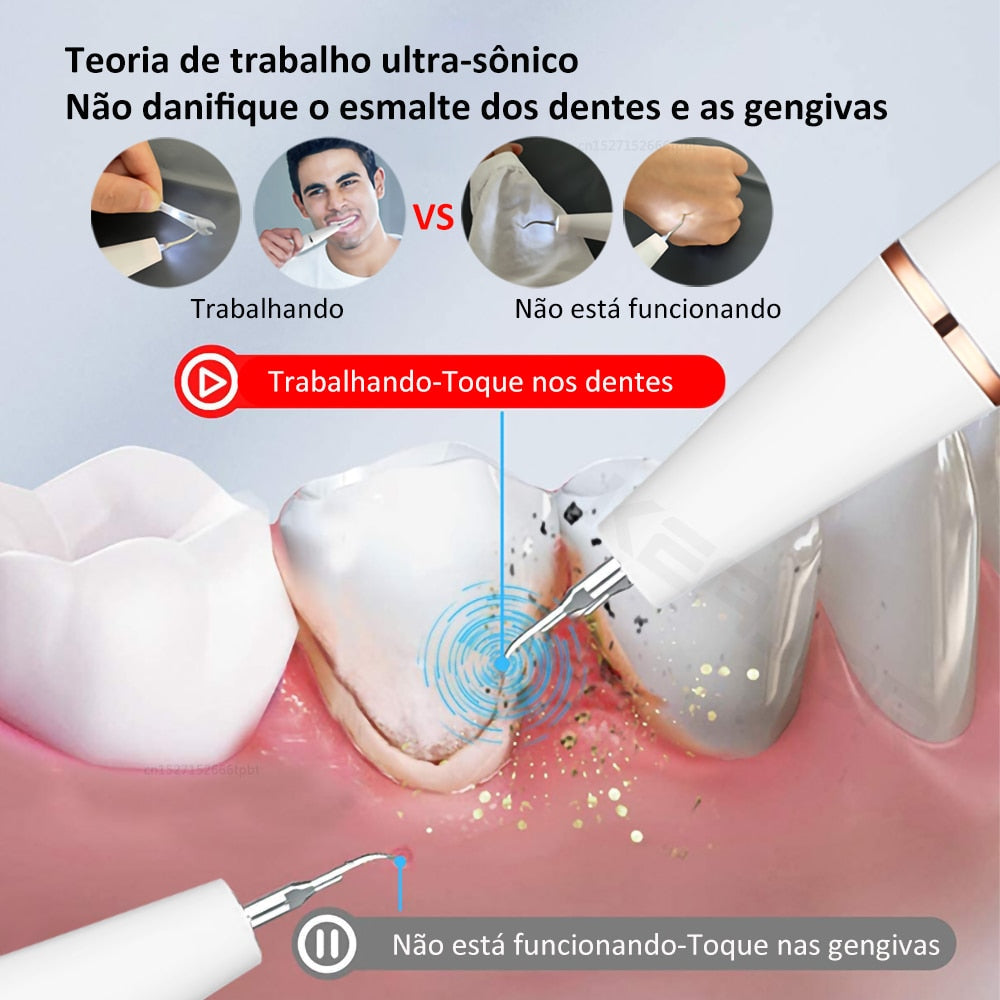 Aparelho p/ Limpeza Dentária Ultrassônico
